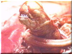 Chestburster