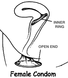 Reality, the Female Condom