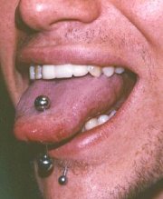 Tongue- and Lip-Ring
